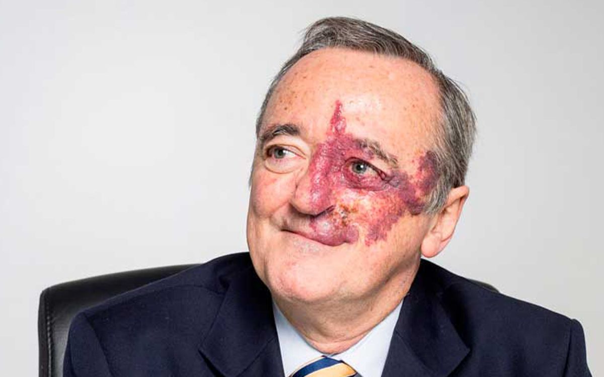 Retiran estudio clave sobre cáncer de páncreas por conflicto de intereses no declarado